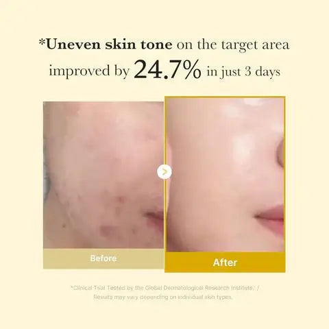 Zaylora™ Medicube - Kojic Acid Turmeric Night Wrapping Mask |  ميديكوب – قناع ليلي بالكوجيك أسيد والكركم